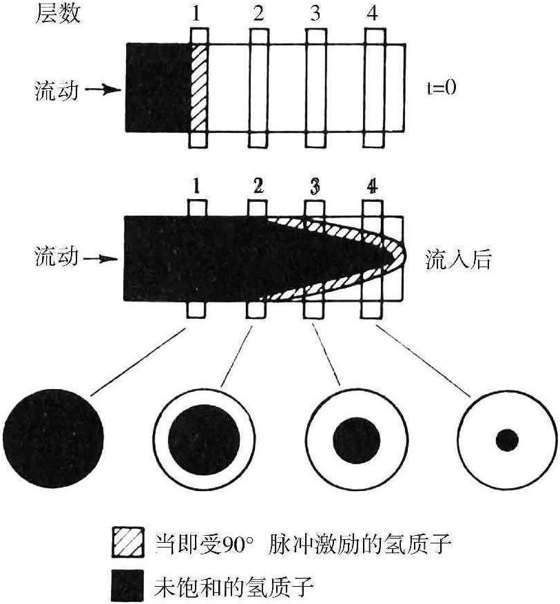 第四節(jié) MRI中的流體成像